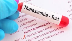 Read more about the article Punjab Govt to introduce legislation for Pre-marriage thalassemia test soon